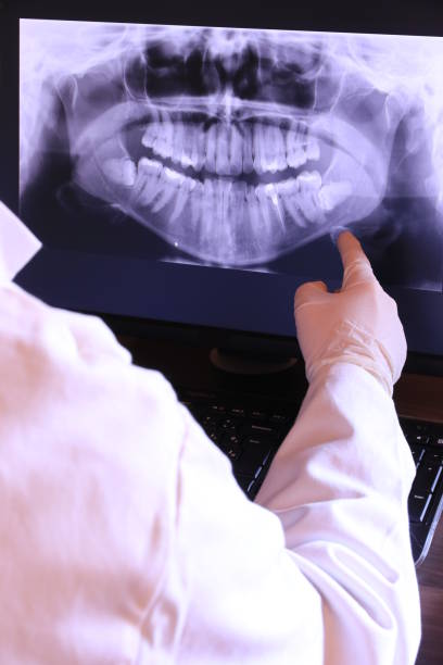 Best Weekend Emergency Dentist in Listoga, CA