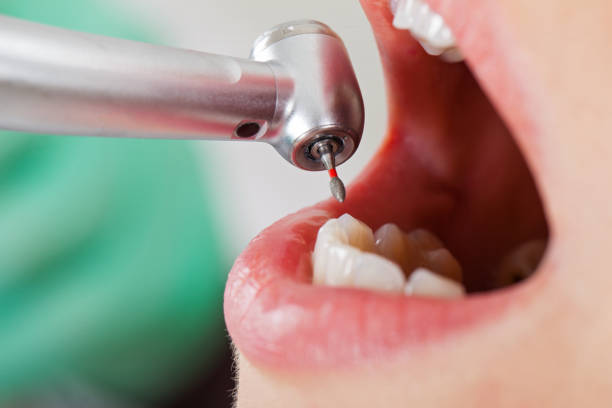 Best Emergency Orthodontic Repairs in Listoga, CA